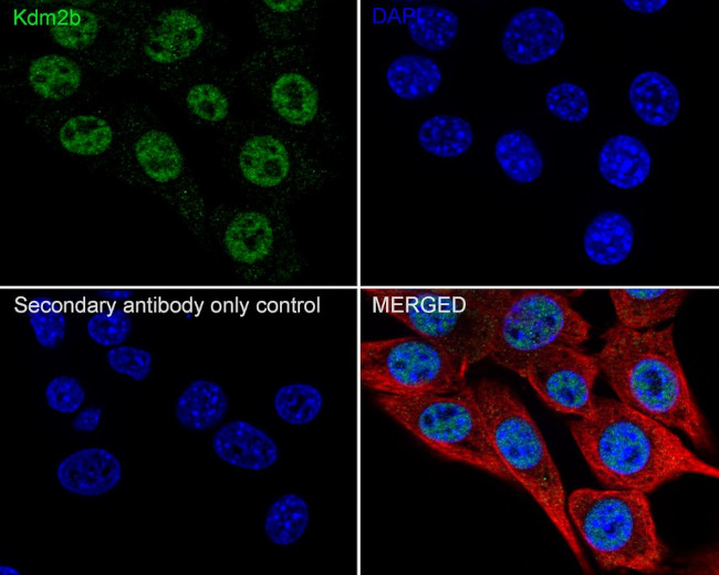 FBXL10 Antibody in Immunocytochemistry (ICC/IF)