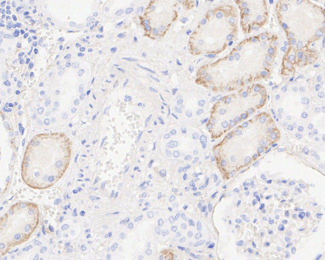 K-cadherin Antibody in Immunohistochemistry (Paraffin) (IHC (P))