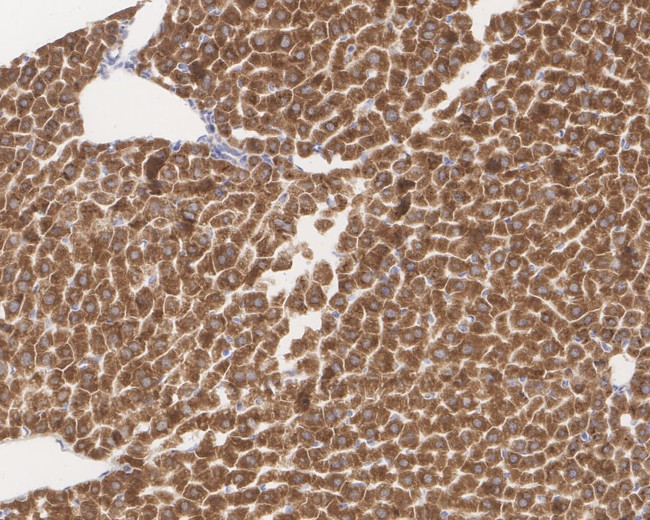 AGL Antibody in Immunohistochemistry (Paraffin) (IHC (P))
