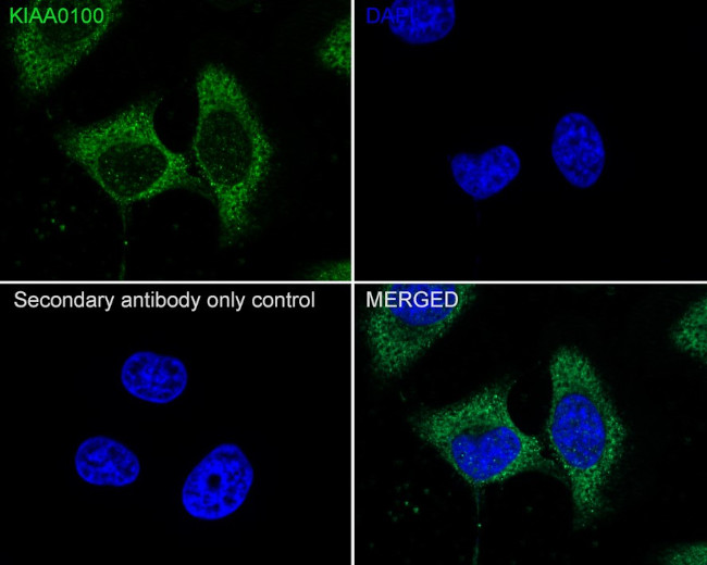 KIAA0100 Antibody in Immunocytochemistry (ICC/IF)