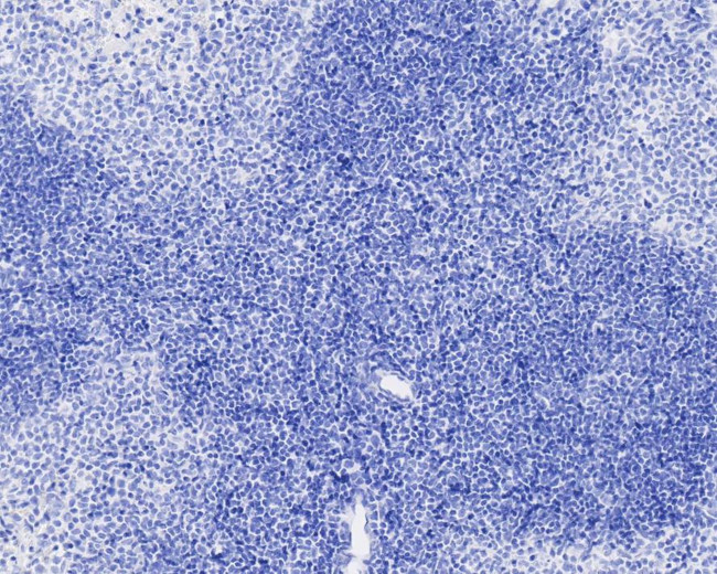 Digoxin Antibody in Immunohistochemistry (Paraffin) (IHC (P))