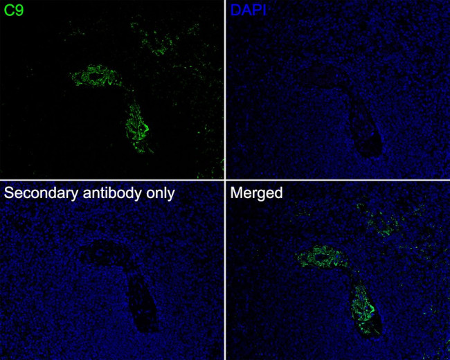 Complement C9 Antibody in Immunohistochemistry (Paraffin) (IHC (P))