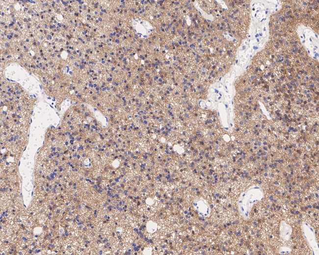GPR56 Antibody in Immunohistochemistry (Paraffin) (IHC (P))