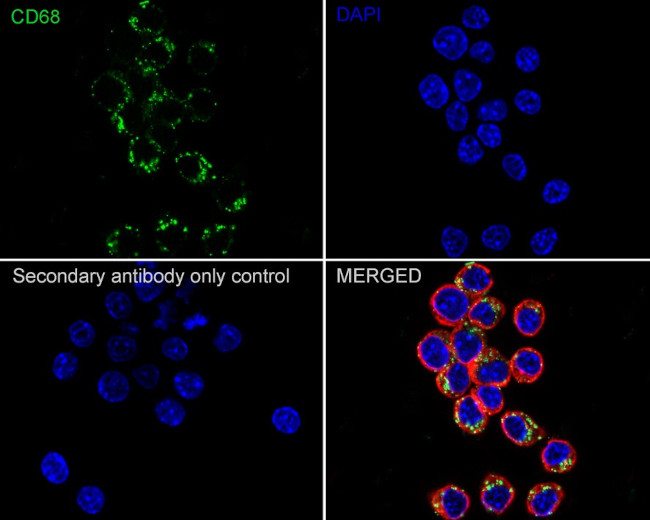 CD68 Antibody in Immunocytochemistry (ICC/IF)