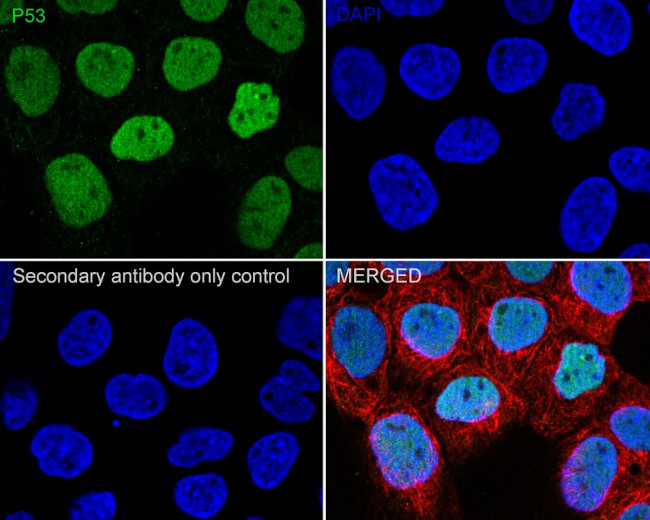 p53 Antibody in Immunocytochemistry (ICC/IF)