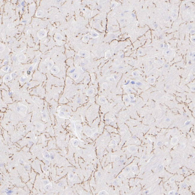 TPH2 Antibody in Immunohistochemistry (Paraffin) (IHC (P))