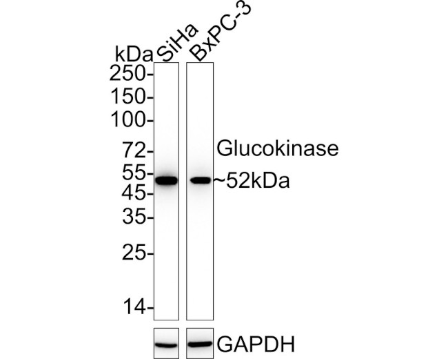 GCK Antibody in Western Blot (WB)