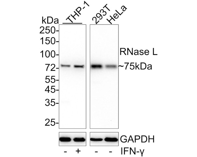 RNaseL Antibody in Western Blot (WB)