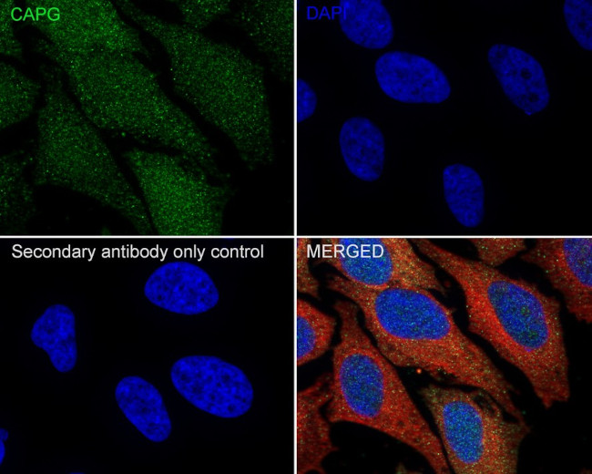 CAPG Antibody in Immunocytochemistry (ICC/IF)