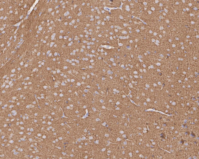 MUNC18 Antibody in Immunohistochemistry (Paraffin) (IHC (P))