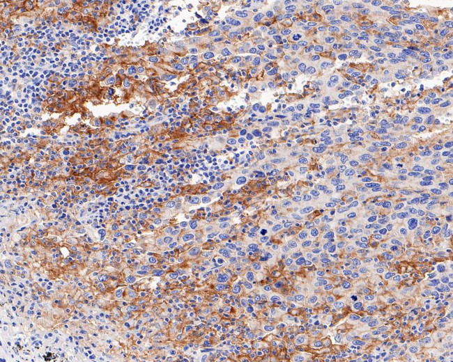 PD-L1 Antibody in Immunohistochemistry (Paraffin) (IHC (P))