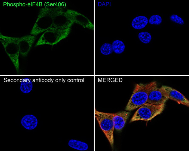Phospho-eIF4B (Ser406) Antibody in Immunocytochemistry (ICC/IF)
