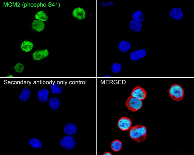 Phospho-MCM2 (Ser41) Antibody in Immunocytochemistry (ICC/IF)