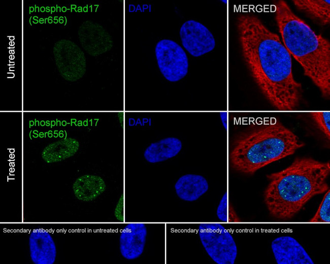 Phospho-RAD17 (Ser656) Antibody in Immunocytochemistry (ICC/IF)