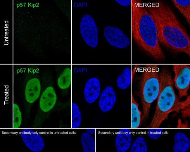 p57 Kip2 Antibody in Immunocytochemistry (ICC/IF)