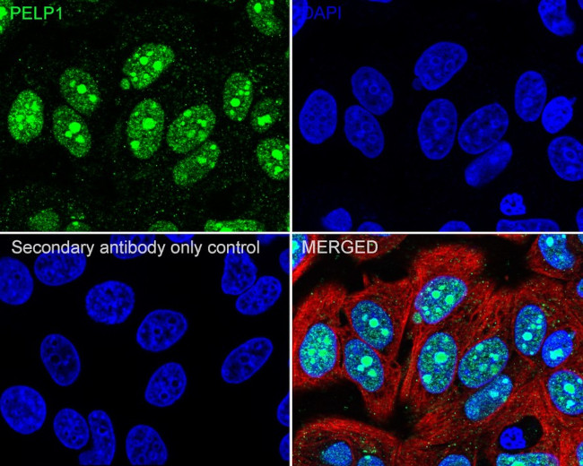 MNAR Antibody in Immunocytochemistry (ICC/IF)