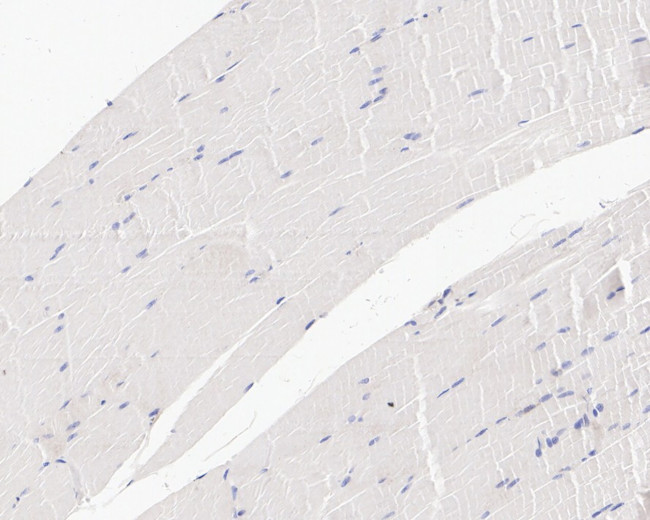 Amyloid Precursor Protein Antibody in Immunohistochemistry (Paraffin) (IHC (P))