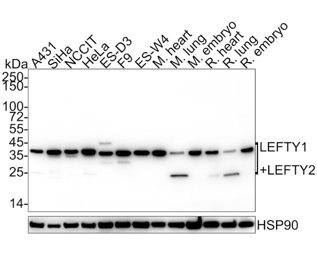 Lefty1/Lefty2 Antibody in Western Blot (WB)