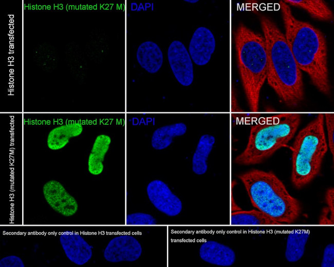 H3K27M Antibody in Immunocytochemistry (ICC/IF)