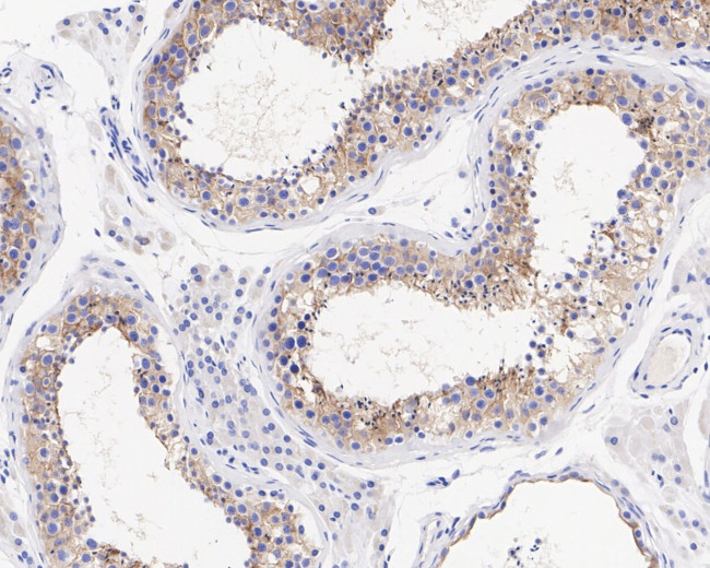 LRP8 Antibody in Immunohistochemistry (Paraffin) (IHC (P))