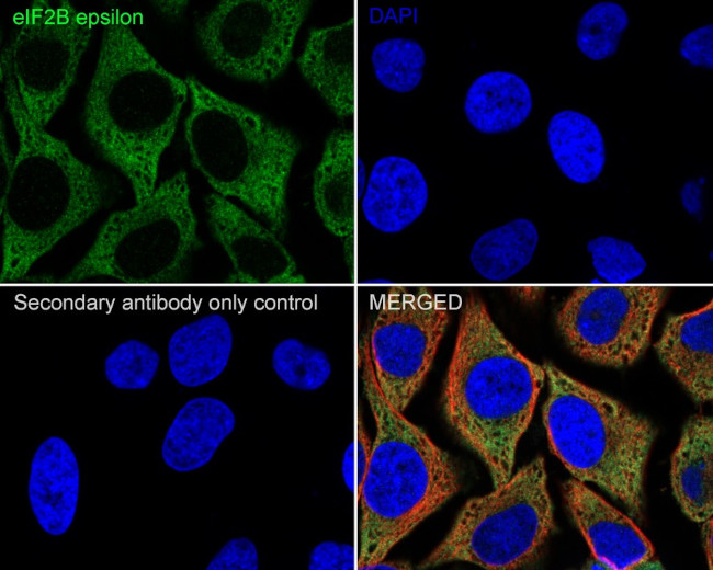 eIF2b epsilon Antibody in Immunocytochemistry (ICC/IF)