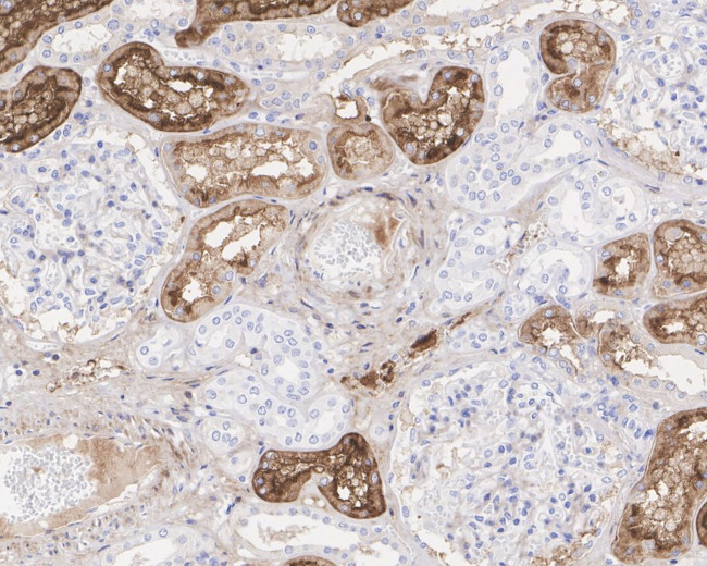 GGT1 Antibody in Immunohistochemistry (Paraffin) (IHC (P))