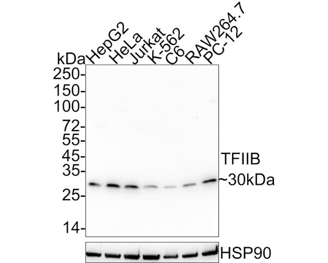 GTF2B Antibody in Western Blot (WB)