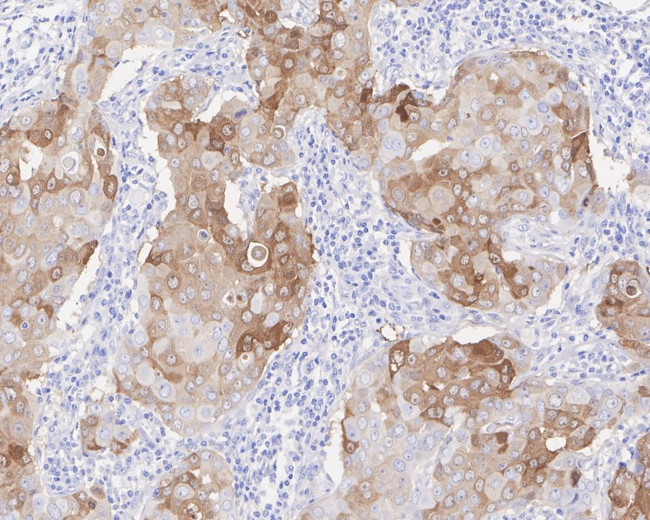 CRABP1 Antibody in Immunohistochemistry (Paraffin) (IHC (P))