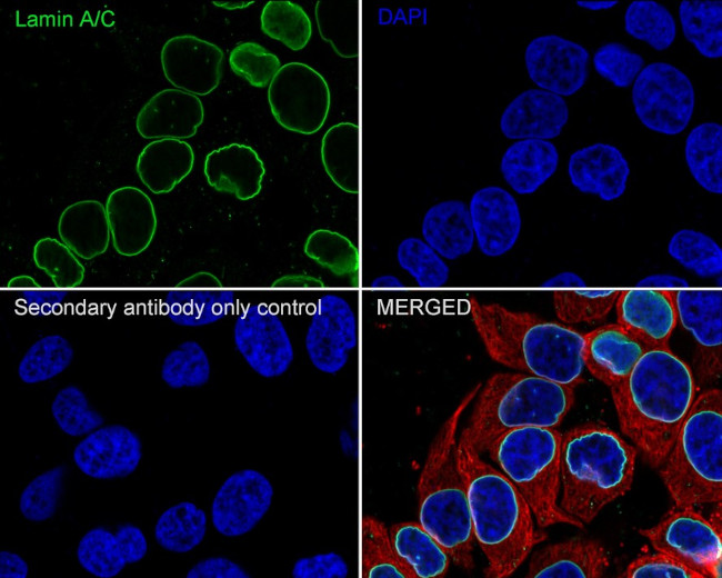 Lamin A/C Antibody in Immunocytochemistry (ICC/IF)