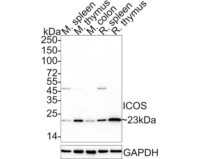 ICOS (CD278) Antibody in Western Blot (WB)