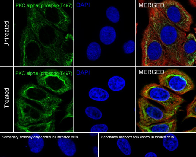 Phospho-PKC alpha (Thr497) Antibody in Immunocytochemistry (ICC/IF)