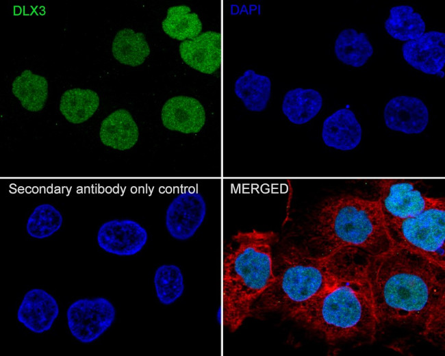 DLX3 Antibody in Immunocytochemistry (ICC/IF)