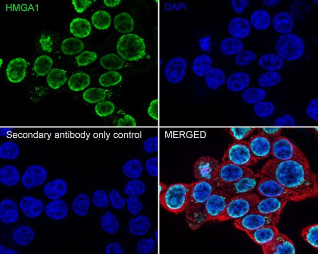 HMGA1 Antibody in Immunocytochemistry (ICC/IF)