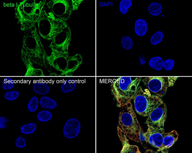 TUBB1 Antibody in Immunocytochemistry (ICC/IF)