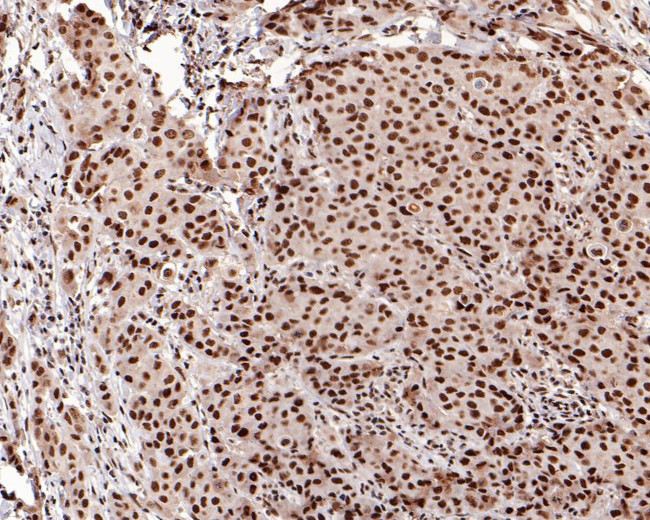 CBP Antibody in Immunohistochemistry (Paraffin) (IHC (P))