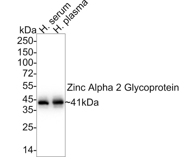 AZGP1 Antibody in Western Blot (WB)