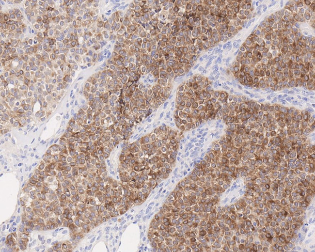 INHA Antibody in Immunohistochemistry (Paraffin) (IHC (P))