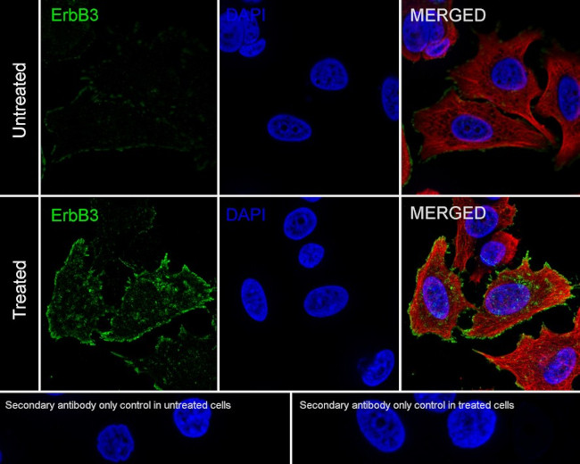 Phospho-ErbB3 (Tyr1289) Antibody in Immunocytochemistry (ICC/IF)
