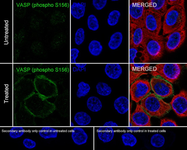 Phospho-VASP (Ser156) Antibody in Immunocytochemistry (ICC/IF)