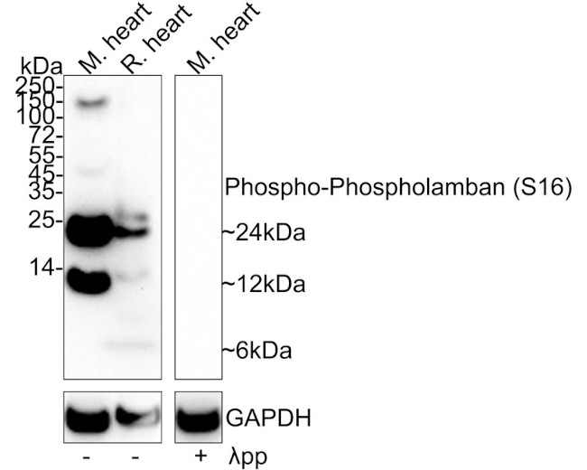 Phospho-Phospholamban (Ser16) Antibody in Western Blot (WB)
