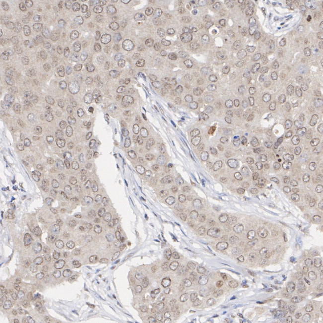 Phospho-AKT1/AKT2/AKT3 (Ser473) Antibody in Immunohistochemistry (Paraffin) (IHC (P))
