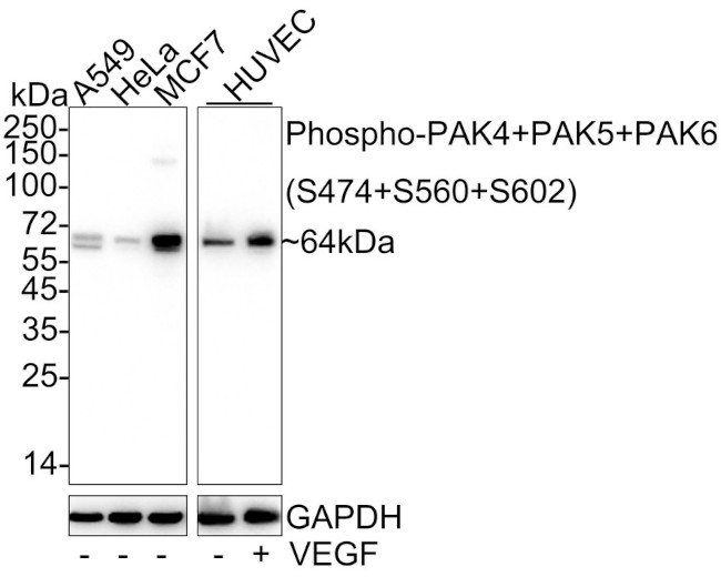 Phospho-PAK4/6/7 (Ser474, Ser602, Ser560) Antibody in Western Blot (WB)