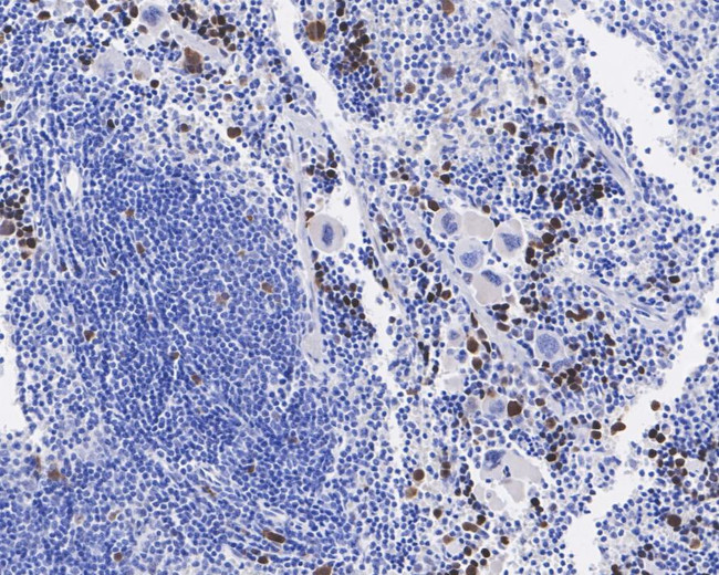 Phospho-CDK1/CDK2/CDK3 (Thr14) Antibody in Immunohistochemistry (Paraffin) (IHC (P))