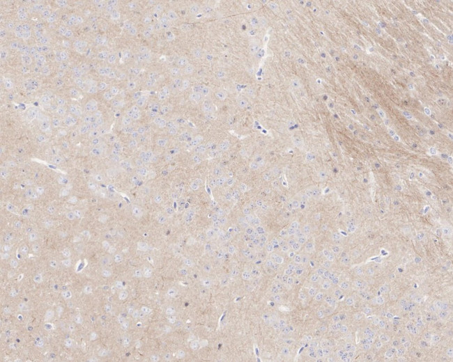 Phospho-Tau (Thr181) Antibody in Immunohistochemistry (Paraffin) (IHC (P))