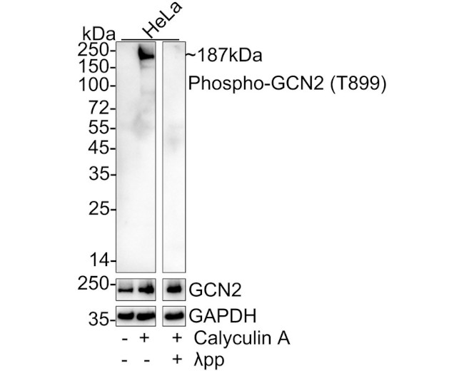 Phospho-GCN2 (Thr899) Antibody in Western Blot (WB)