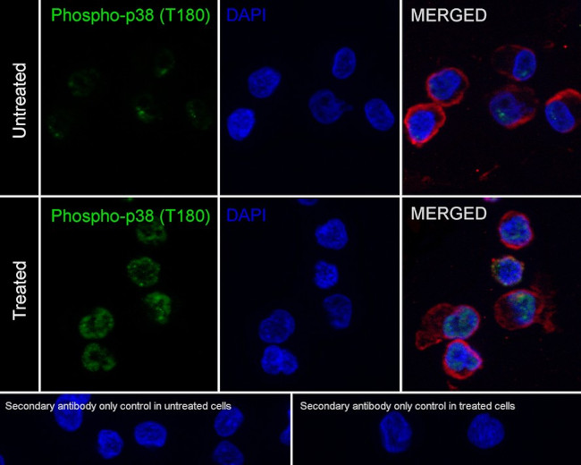 Phospho-p38 MAPK (Thr180) Antibody in Immunocytochemistry (ICC/IF)