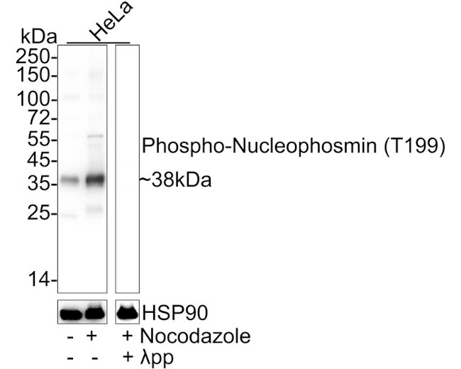 Phospho-NPM1 (Thr199) Antibody in Western Blot (WB)
