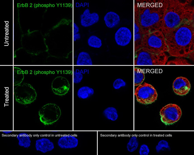 Phospho-ErbB2 (HER-2) (Tyr1139) Antibody in Immunocytochemistry (ICC/IF)