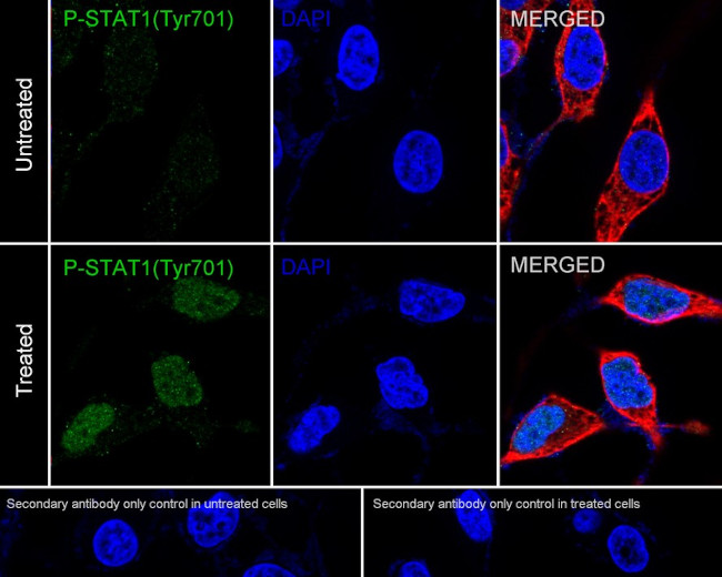 Phospho-STAT1 (Tyr701) Antibody in Immunocytochemistry (ICC/IF)