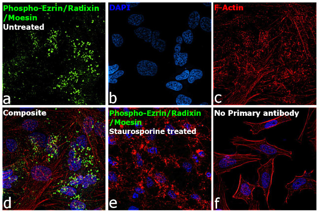 Phospho-Ezrin/Radixin/Moesin (Thr567, Thr564, Thr558) Antibody in Immunocytochemistry (ICC/IF)
